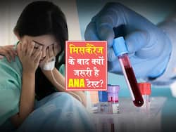 मिसकैरेज होने पर क्‍यों जरूरी है ANA टेस्‍ट? जानिए क्‍या होता है ANA ब्‍लड टेस्‍ट और क्‍या है इसके पॉजिटिव आने का मतलब