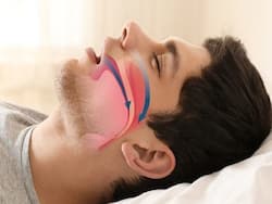 Obstructive Sleep Apnea Can Be Fatal: 5 Things That You Should Know