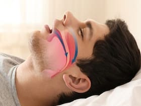 Obstructive Sleep Apnea Can Be Fatal: 5 Things That You Should Know Obstructive Sleep Apnea Can Be Fatal: 5 Things That You Should Know
