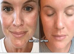 5 Treatments To Look Your Best On Valentine   s Day
