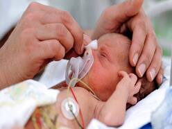 Worried About Preterm Babies' Development? All You Need To Know From A Neonatologist