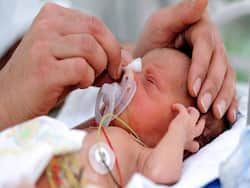 Worried About Preterm Babies' Development? All You Need To Know From A Neonatologist