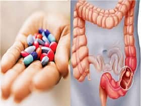 Antibiotics Likely Putting Young People At Greater Risk Of Developing Colon Cancer: Study
