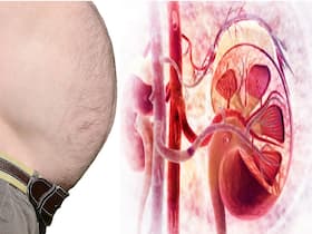 Obesity Increases Risk Of Kidney Disease: Here Are The Best Yoga Poses For Weight Loss