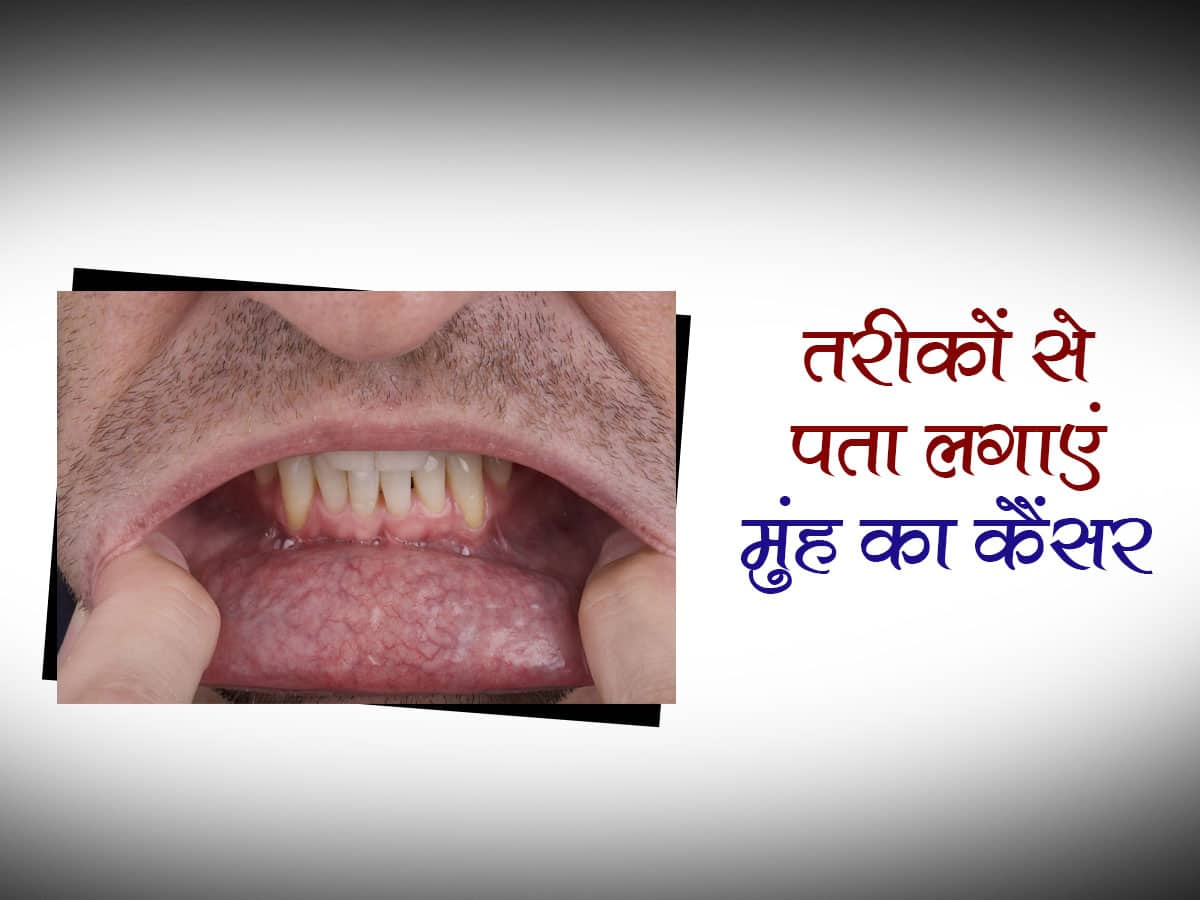 Lips Cancer Symptoms In Hindi Lipstutorial Org