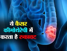 कीमोथेरेपी लेने वाले लोगों के लिए ठीक होने में रुकावट पैदा करता है ये कैंसर! स्टडी में खुलासा ये कैंसर आपके लिए 'राह का रोड़ा' कीमोथेरेपी लेने वाले लोगों के लिए ठीक होने में रुकावट पैदा करता है ये कैंसर! स्टडी में खुलासा ये कैंसर आपके लिए 'राह का रोड़ा'