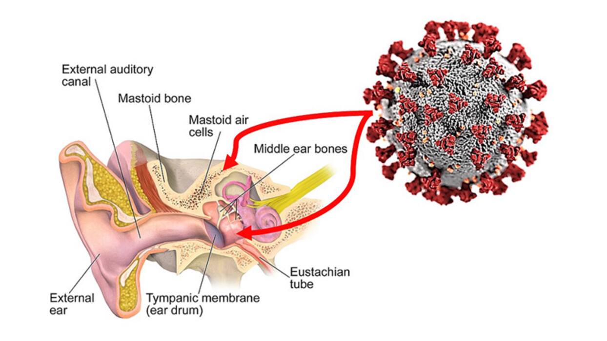 Continuous Ringing In The Ears To Hearing Loss: Unusual Long-COVID Symptoms Reported Recently