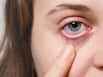 Mind The Heat! Here's How Using Heaters Can Harm Your Eyes