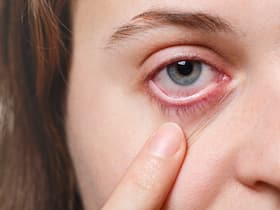 Look Out For These Common Eye Infections That Can Cause Permanent Vision Loss Look Out For These Common Eye Infections That Can Cause Permanent Vision Loss