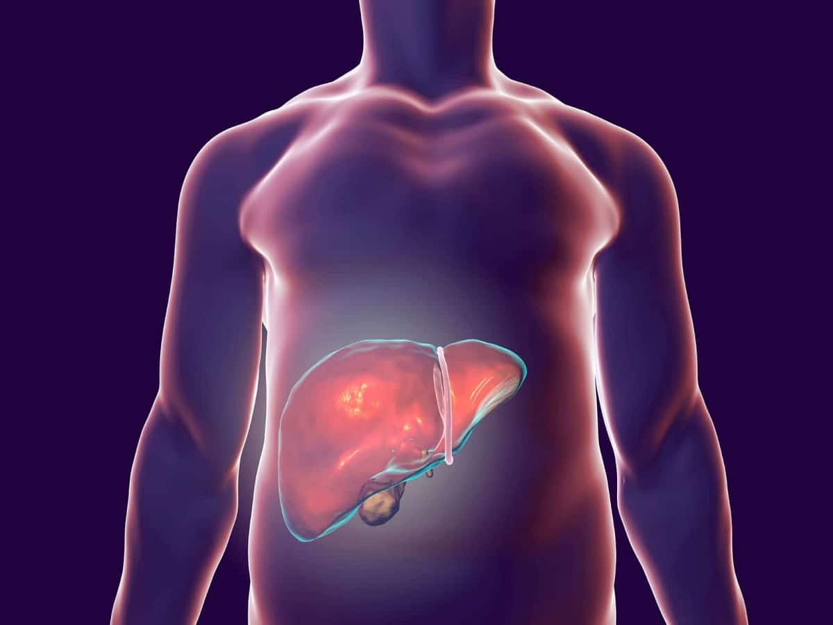 It Is Possible To Reverse Fatty Liver Disease Heres How 