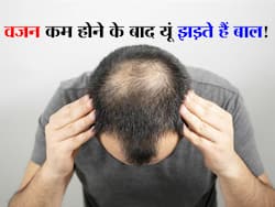 वजन कम होने के बाद बालों का झड़ना हुआ शुरू? जानें इसके पीछे की असल वजह और बालों को बचाने के उपाय