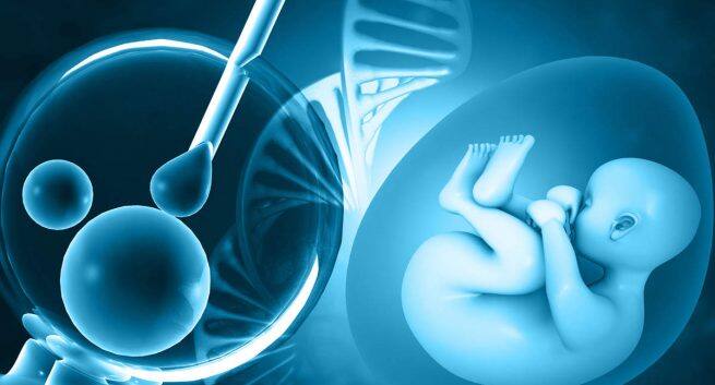ivf-fertility