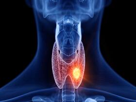 Keep Your Thyroid In Control With These 5 Expert-Approved Foods