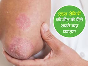 टीबी से नहीं बल्कि इस बीमारी की वजह से जाती है एड्स रोगियों की सबसे ज्यादा जान! जानें कौन सी है ये बीमारी