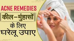 Acne Treatment: पिंपल्स के लिए अपनाएं ये घरेलू नुस्ख़े, गायब हो जाएंगे सारे दाग, देखें- WATCH
