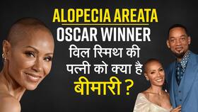 Alopecia Areata: ऑस्कर विनर विल स्मिथ की पतनी को है ये बीमारी, जानिए क्या है एलोपेसिया