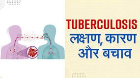 World TB Day 2022: खांसी के अलावा भी हैं टीबी के कई लक्षण, एक्सपर्स से जानें कैसे करें इस बीमारी से बचाव