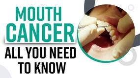 Explained: Why Mouth Cancer In India Is On A Sudden Rise? Causes And Treatment, Expert Speaks