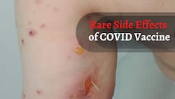 Blisters To Full Body Erosions: 5 Rare Autoimmune Conditions Suffered By COVID-19 Vaccine Recipients