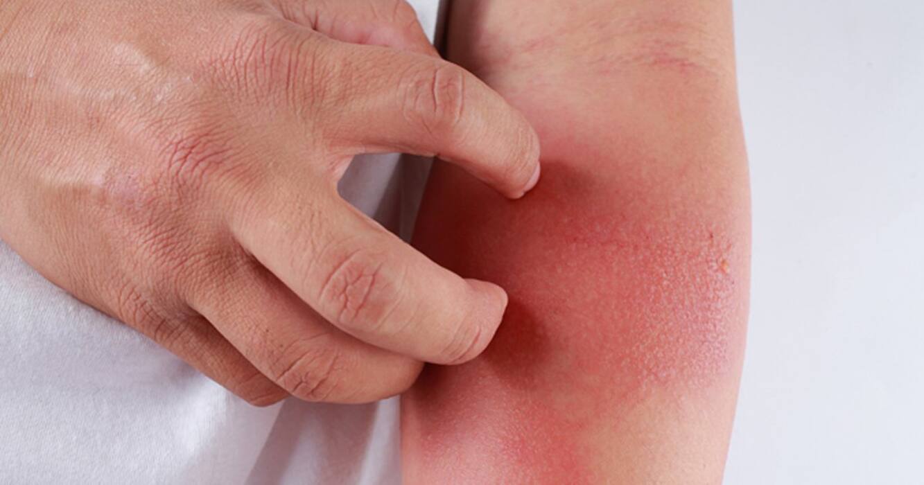 Scaly Patches To Burning Sensation: Beware of THESE 5 Warning Symptoms of Severe Skin Diseases