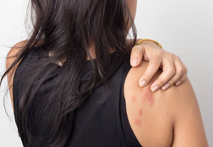 Scaly Patches To Burning Sensation: Beware of THESE 5 Warning Symptoms ...