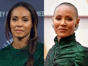 Will Smith   s Wife Jada Smith Suffers From This Autoimmune Condition; Know All About It
