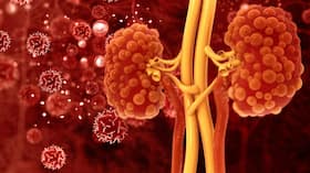 Polycystic Kidney Disease: How Does It Affect The Kidneys?