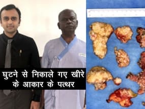 मुंबई के डॉक्टरों ने की दुर्लभ सर्जरी,70 वर्षीय व्यक्ति के घुटने से निकाले 'खीरे के आकार के पत्थर'
