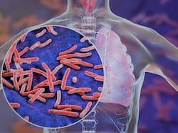 World Tuberculosis Day 2022: कोरोना की तरह फैलता है टीबी, जागरूकता और सतर्कता ही बचा सकती है जान