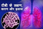 टीबी (Tuberculosis)