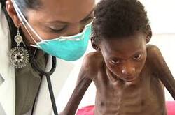 Tuberculosis In Kids: WHO Shares Guidelines To Manage This Severe Lung Infection