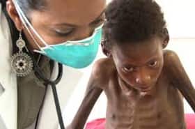 Tuberculosis In Kids: WHO Shares Guidelines To Manage This Severe Lung Infection
