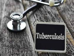 World TB Day 2022: A Multipronged Strategy Required To End Tuberculosis