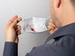 Man Suffers Severe Episodes Of Coughing Up Blood, Doctors Remove A Large Fungal Ball From His Right Lung