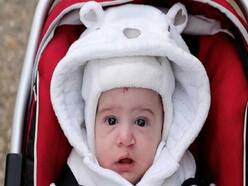 World Birth Defect Day: Common Birth Defects And How One Can Reduce The Risk