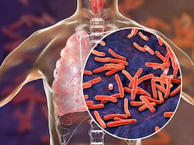 Spain To Roll Out Omicron Boosters, Monkeypox Outbreak Reaches Jordan