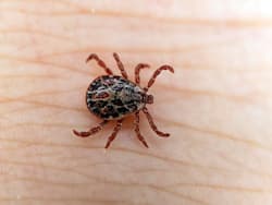 Crimean-Congo Haemorrhagic Fever Case Identified In UK: People Told To Avoid Contact With Ticks