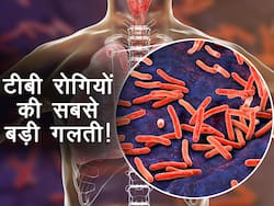 World Tuberculosis day 2022: कमजोर इम्यूनिटी से कोविड-19 ही नहीं होता है TB भी! जानें कौन सी गलती है रोगी को सबसे ज्यादा भारी