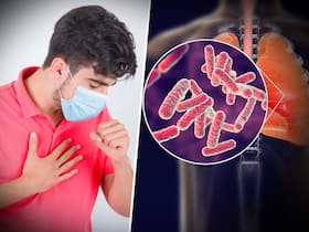 65% Of Tuberculosis Cases In India Are In 15-45 Age Group: Why Youngsters Are Becoming Prone To TB?