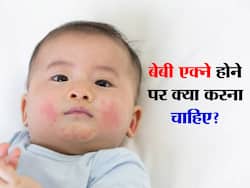शिशुओं के चेहरे पर दिखने वाले लाल दाने क्या हैं किसी गम्भीर समस्या का संकेत, साथ ही पढ़ें इससे राहत के उपाय