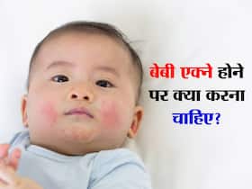 शिशुओं के चेहरे पर दिखने वाले लाल दाने क्या हैं किसी गम्भीर समस्या का संकेत, साथ ही पढ़ें इससे राहत के उपाय