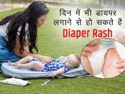 Diaper Rash: अगर दिन में भी लगा रही हैं बेबी को डायपर तो हो जाएं सावधान! इन 5 बातों का ध्यान रखना है बहुत जरूरी