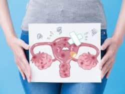 पीरियड्स में पेशाब करने के दौरान जलन होना किसी अंदरूनी बीमारी के हैं संकेत, एंडोमेट्रियोसिस का भी हो सकता है कारण