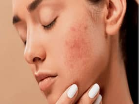 Don't Ignore Facial Redness! It Could Be A Sign Of A Serious Skin Condition