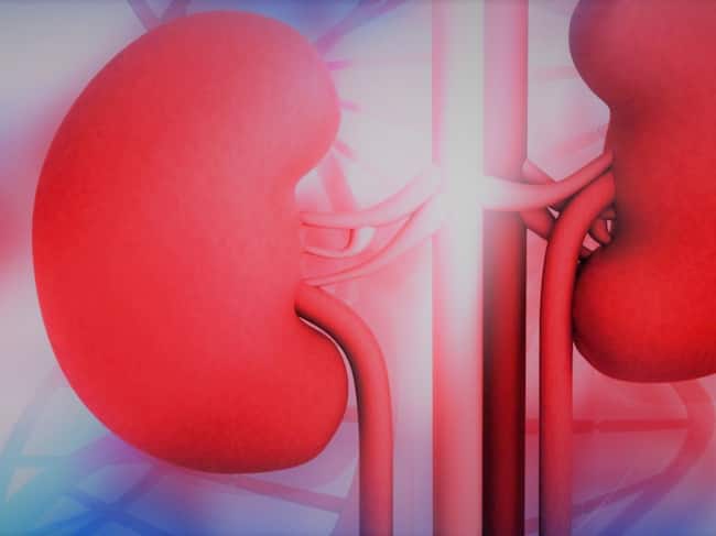 kidney-disease