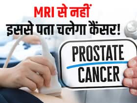 अल्ट्रासाउंड से लग जाएगा पता प्रोस्टेट कैंसर है या नहीं! शोध में खुलासा कैसे काम करती है ये तकनीक