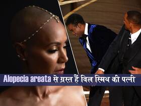 Alopecia Areata बीमारी से ग्रस्त हैं हॉलीवुड एक्टर Will Smith की पत्नी जैडा, जानें क्या हैं इस बीमारी के लक्षण, कारण व इलाज