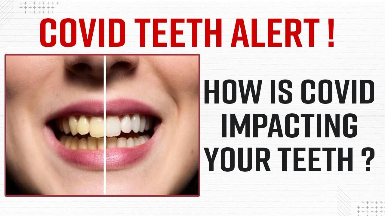 covid-19-after-effects-dental-signs-and-symptoms-you-just-cannot-miss