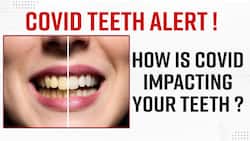 Covid-19 After Effects? Dental Signs And Symptoms You Just Cannot Miss - Watch