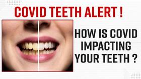 Covid-19 After Effects? Dental Signs And Symptoms You Just Cannot Miss - Watch